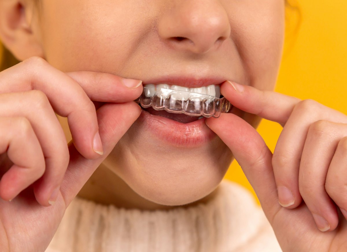 Orthodontie (photo d'illustration)